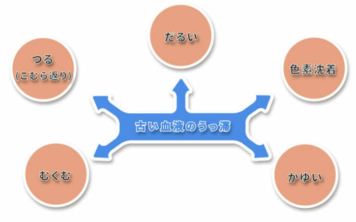 下肢静脈瘤の症状